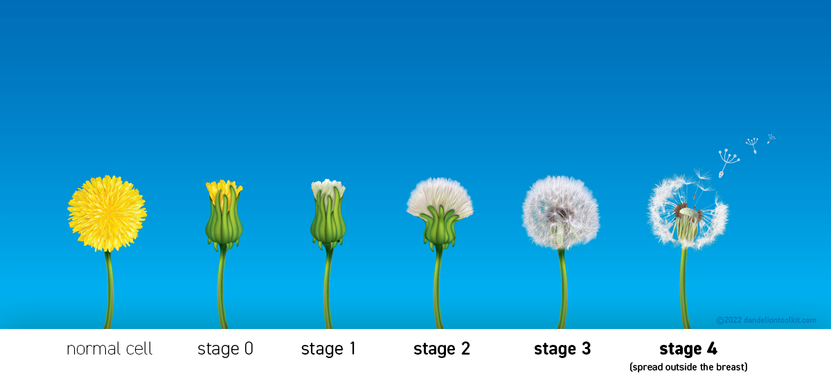 Understanding Stages of Cancer using the Dandelion visual metaphor from Stage 0 to Stage IV